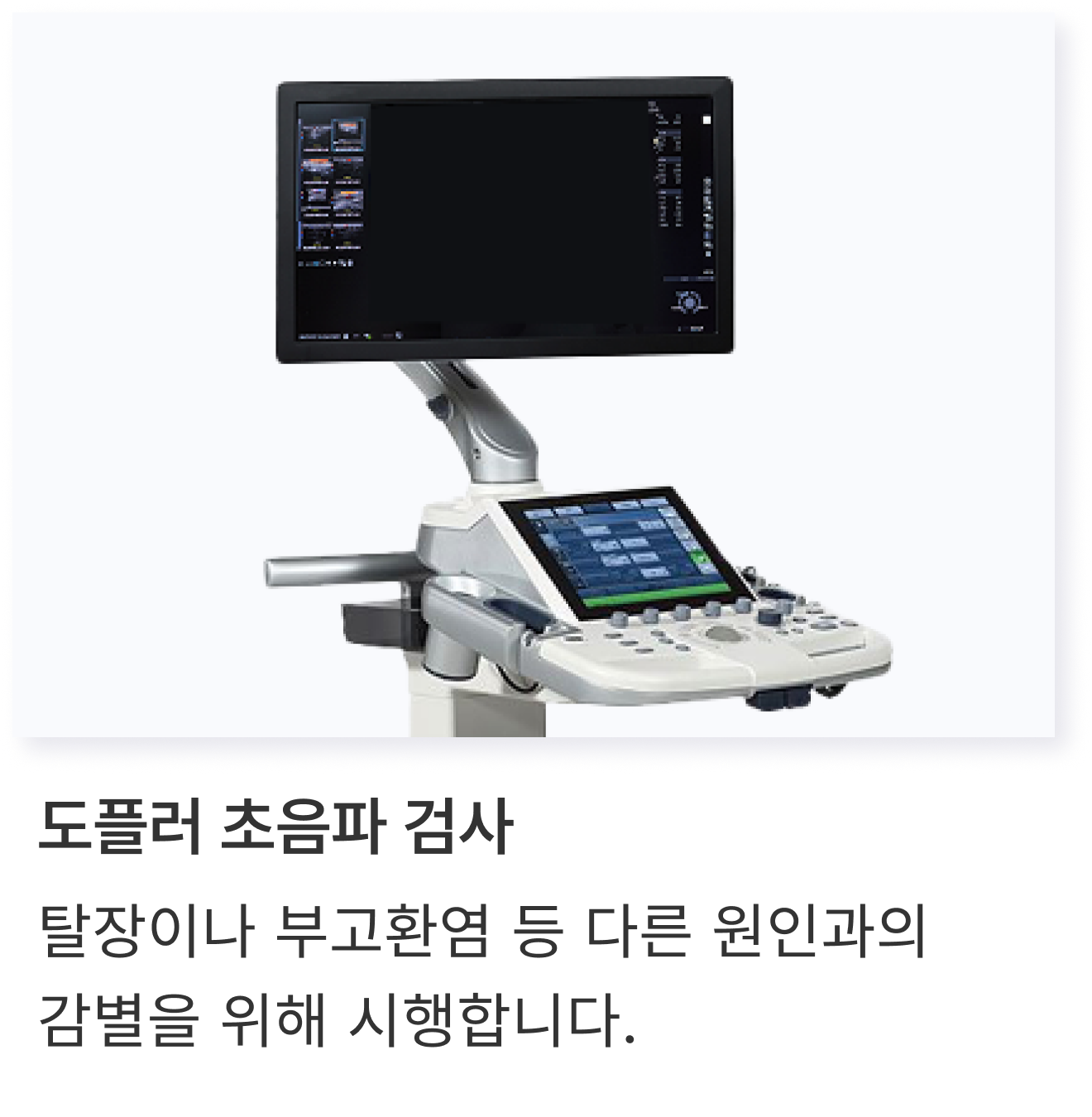 varicocele_04_02